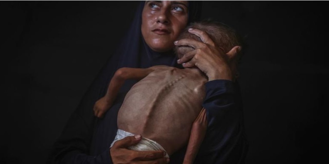 Gazze’de Açlık Can Alıyor: Bebek Hud Arafat Yaşamını Yitirdi