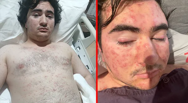 Özel hastanede 30 bin TL iddiası: Genç devlet hastanesinde tedavi edildi