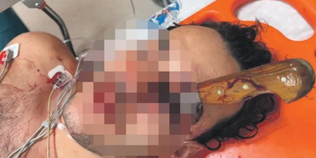 Konya’da 10 Dakika Arayla İki Bıçaklı Saldırı: Bir Genç Ağır Yaralandı