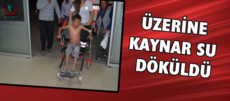 Üzerine kaynar su dökülen çocuk tedavi altına alındı